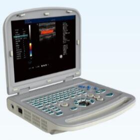 China New Arrival- 15 inch Laptop Color Doppler Ultrasound Diagnostic System EW-C15 with Vaginal wholesale