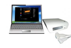 China Color Doppler Ultrasound box system machine wholesale