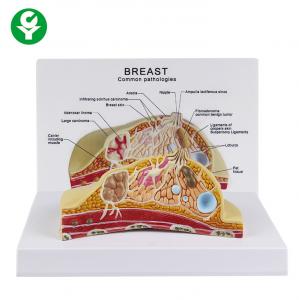 China Female Cross Section Breast Cancer Model Anatomical 1.0 Kg Single Gross Weight wholesale