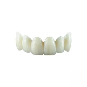 China Natural Color Zirconia Tooth Crown Less Transparent Molars No Black Lines On The Edges on sale