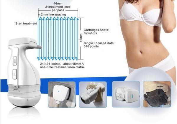 2016 Newest Model Ultrashape / Liposonix / HIFU Slimming Machine with good quality