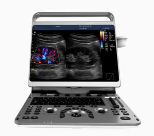 China Portable Cardiac Ultrasound Machine Chison EBit 50 16.5lbs wholesale