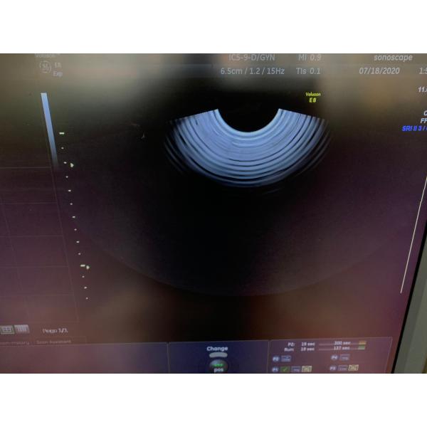 GE endovaginal array original ultrasound transducer IC5-9-D Logiq S7