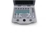 10.4 Inch Screen Portable Ultrasound Scanner Color Doppler Machine With Trolley