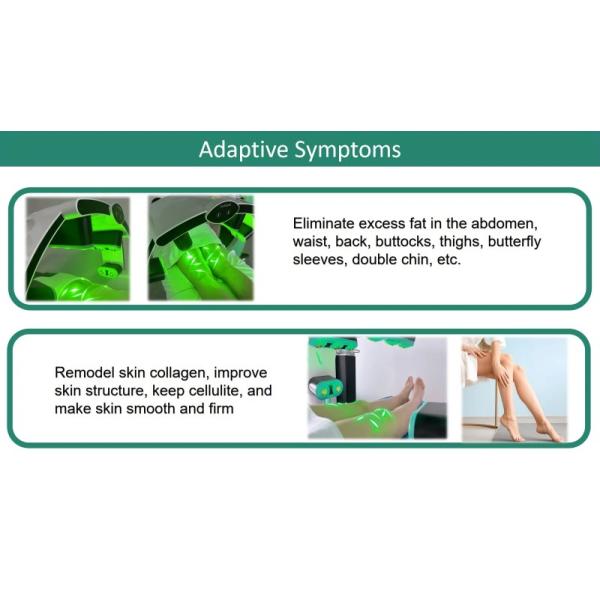 Slim Cold Laser Physiotherapy Machine 10D Green Diode Emerald Laser Fat Reduce Device