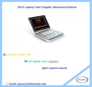 China Laptop Color Doppler Ultrasound System wholesale
