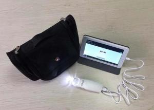 China Vaginal Videoscope Digital Video Colposcope Connected to Computer / TV with 3 Million Pixels to Take Photo for Cervix wholesale